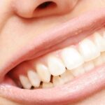 4 Tips for healthy teeth