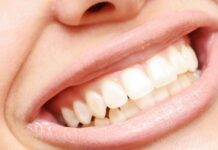 4 Tips for healthy teeth