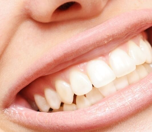 4 Tips for healthy teeth