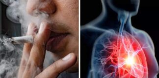 Impacts of Smoking on your health