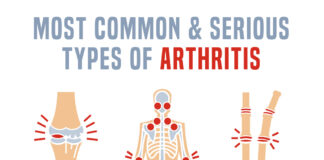 Common types of arthritis