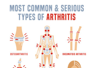 Common types of arthritis