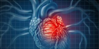 Common heart disease