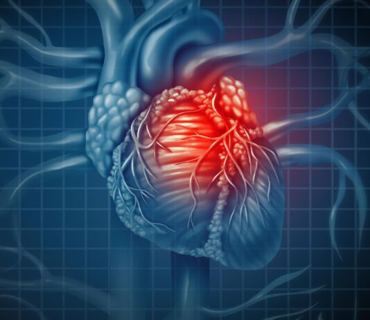 Common heart disease