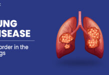 Lung Disease Overview