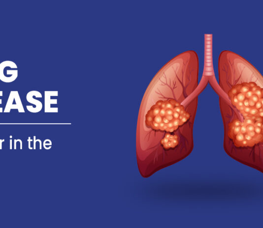 Lung Disease Overview