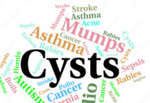 Understanding Cyst